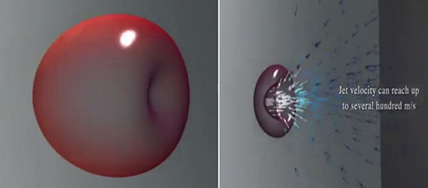 ultrasonic bubble
